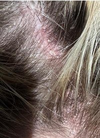 CLEAN THE PROBLEM. CONDITION THE SKIN. RECALIBRATE THE SURFACE.